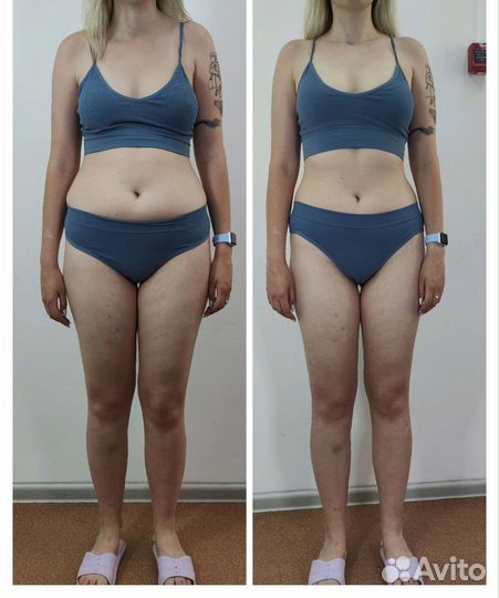 Кавитация/Коррекция фигуры