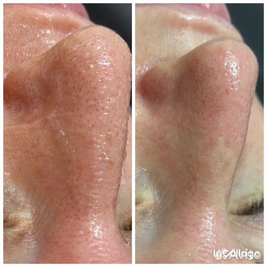 Услуги косметолога массажи инъекции чистка лица