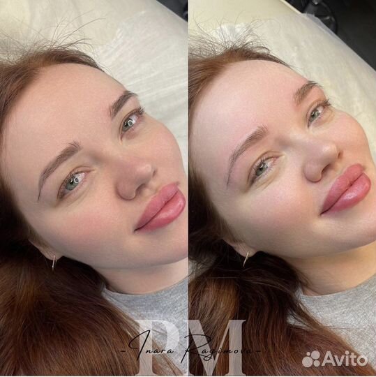 Лазерное удаление татуировок и татуажа