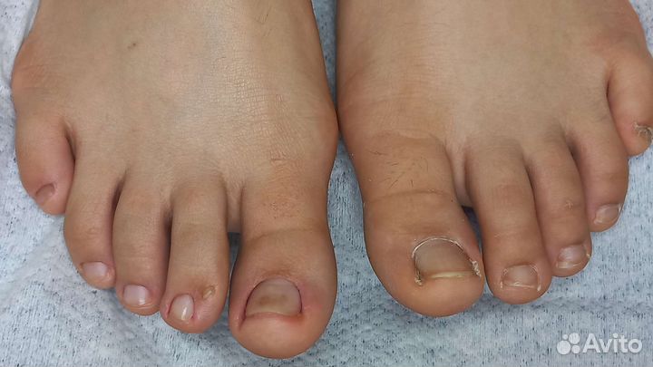 Смарт педикюр