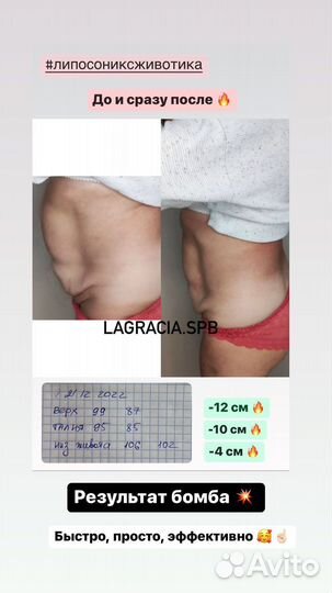 Липосоникс