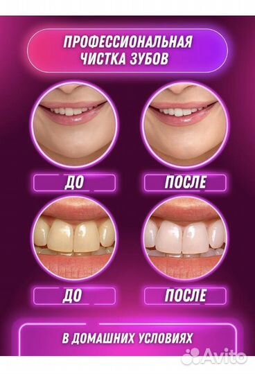 Электрическая зубная щетка ирригатор для зубов