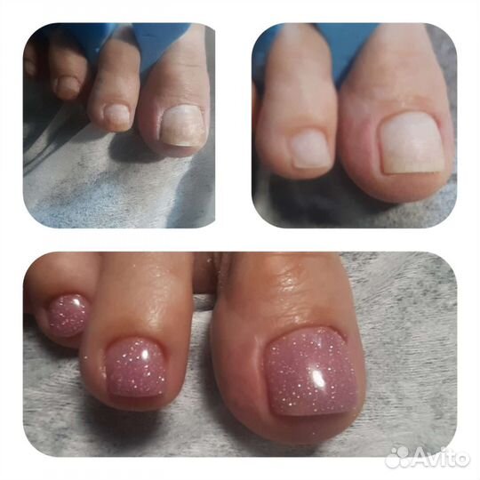 Маникюр педикюр на дому