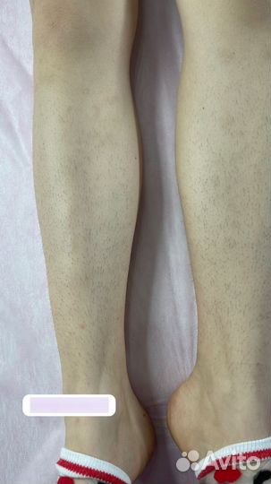 Шугаринг/Воск