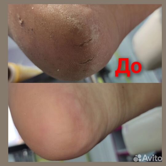 Маникюр(модели) Смарт педикюр