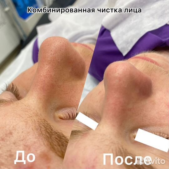 Услуги косметолога