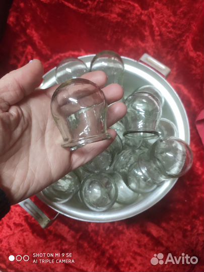 Банки медицинские со времен СССР для лечения