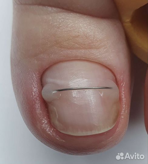 Услуги подолога, мастера педикюра и маникюра