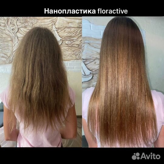 Нанопластика floractive, ботокс, биксипластия