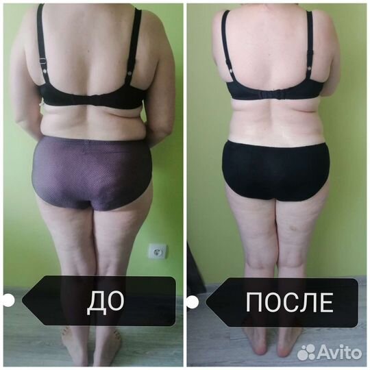 Lpg-массаж,rf-лифтинг,кавитация,вакуум,липолазер