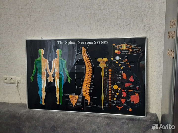 Световое табло Макет позвоночника