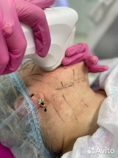 Косметологическое оборудование от поставщика