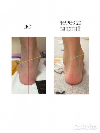 Коррекционная гимнастика