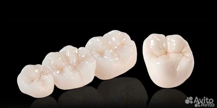 Изготовление любых зубных коронок и протезов