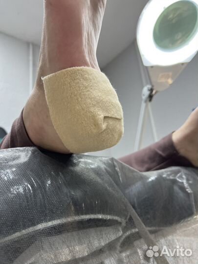 Подолог(вросший ноготь,трещины,мозоли бородавки)