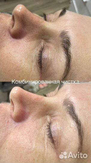 Косметологические услуги