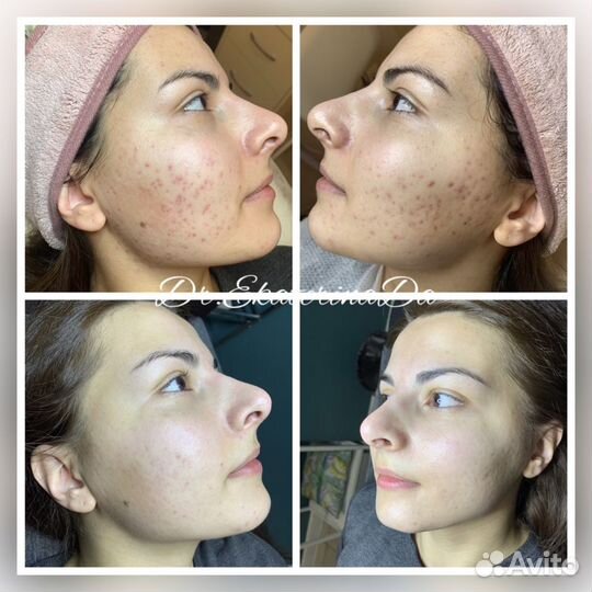 Врач дерматолог, косметолог