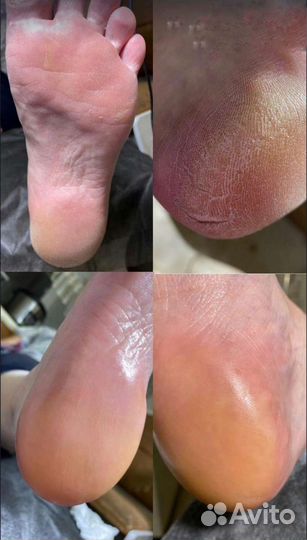 Маникюр педикюр депиляция