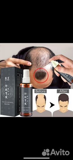 Тоник для волос