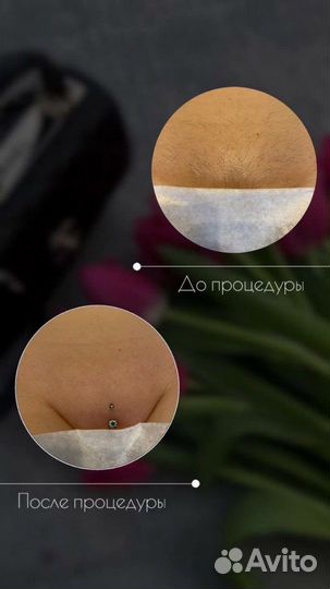 Шугаринг Ваксинг