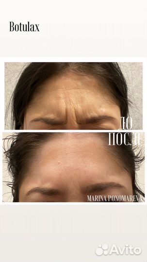 Услуги косметолога