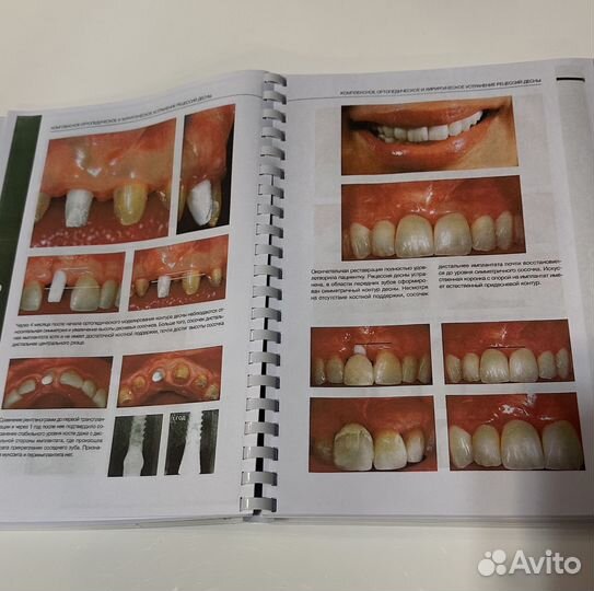 Пластическая хирургия мягких тканей Зукелли 2023