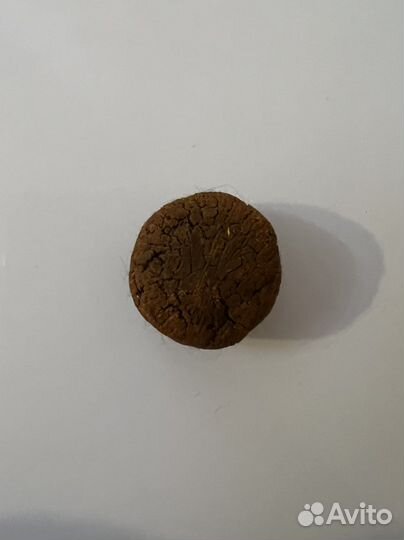 Желчный камень