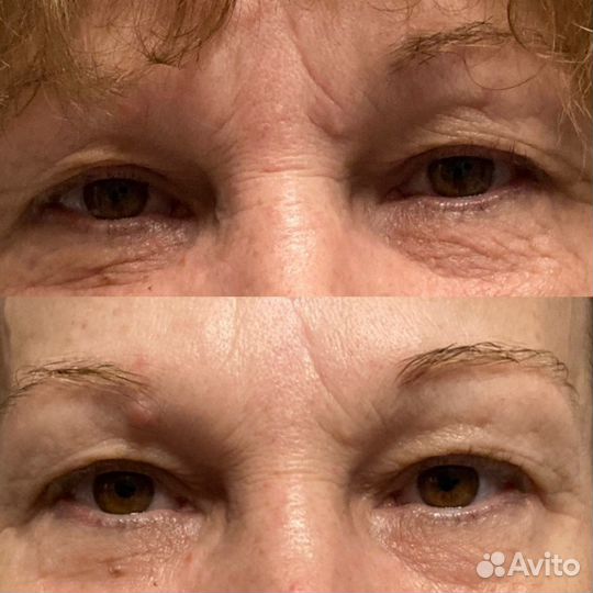 Комплекс самомассажа лица