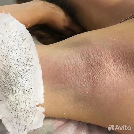 Депиляция воском: бёдра