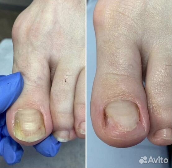 Маникюр.педикюр.Подолог