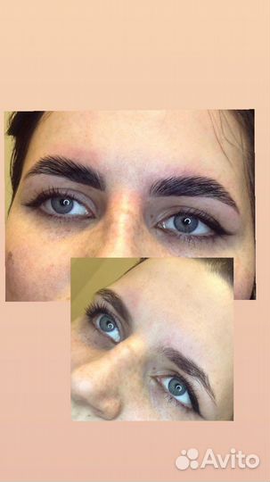 Бровист Кимры