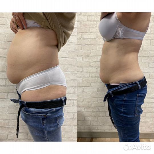 LPG лпж массаж в Красноярске