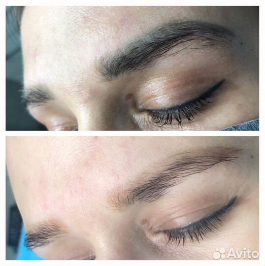 Модель на Удаление тату / Перманентного макияжа