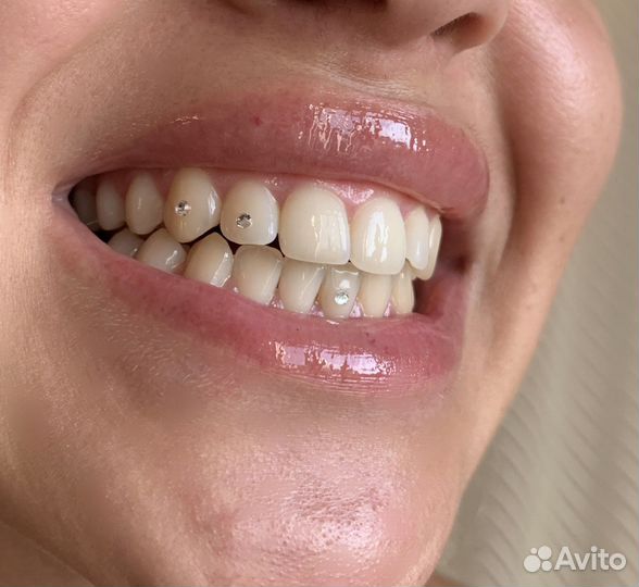 Сертификат на установку скайсов казань скайсы