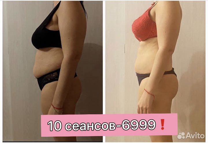 Массаж, Антицеллюлитный массаж, Коррекция фигуры