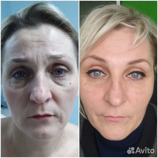 Программа стройное лицо И тело