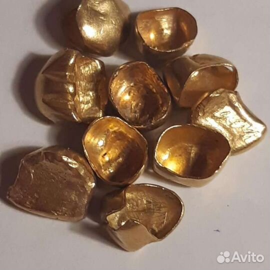 Золотые коронки