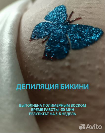 Депиляция