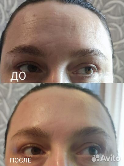 Аппаратный массаж, коррекция фигуры, чистки лица