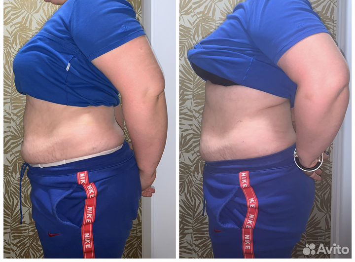 Аппаратная коррекция фигуры