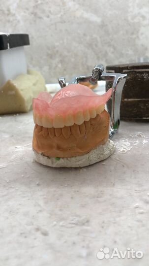 Съемные зубные протезы