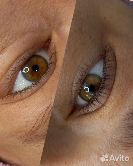 Шугаринг Полевской