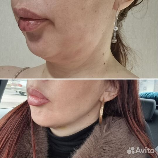 Программа стройное лицо И тело