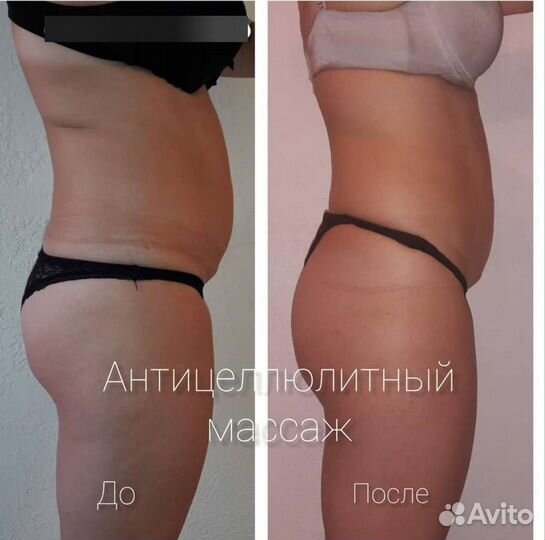 Массаж Тела(Коррекция Фигуры) Лечим Спину(Горбы)