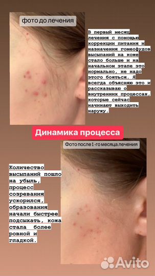 Консультация нутрициолога