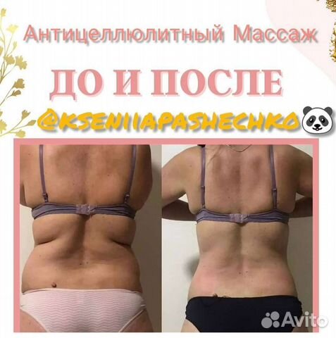 Массаж Тела(Коррекция Фигуры) Лечим Спину(Горбы)