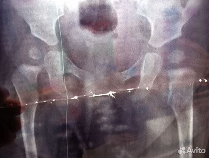 Рентгеновские снимки