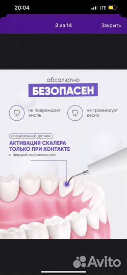 Ультразвуковой скалер