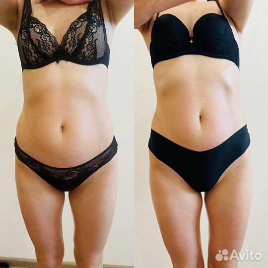 Модель на аппаратный массаж