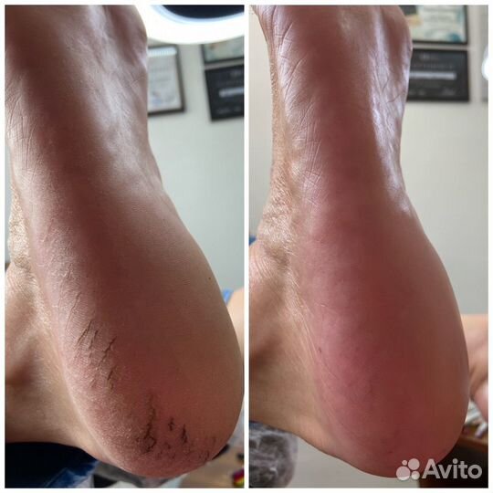 Подолог, мастер педикюра